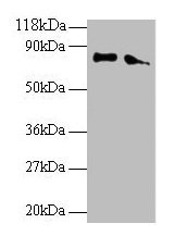 Western blot All lanes: ERP29 antibody at 2µg/ml Lane 1: EC109 whole cell lysate Lane 2: 293T whole cell lysate Secondary Goat polyclonal to rabbit IgG at 1/15000 dilution Predicted band size: 29, 6 kDa Observed band size: 80 kDa