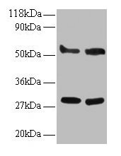 Western blot All lanes: ERP29 antibody at 2µg/ml Lane 1: EC109 whole cell lysate Lane 2: 293T whole cell lysate Secondary Goat polyclonal to rabbit IgG at 1/15000 dilution Predicted band size: 29, 6 kDa Observed band size: 29, 55 kDa
