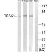 Western blot analysis of extracts from rat heart cells, rat kidney cells and rat liver cells, using TESK1 antibody.