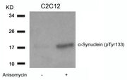 Western blot analysis of extracts from C2C12 cells untreated or treated with Anisomycin using a-Synuclein(Phospho-Tyr133) Antibody.