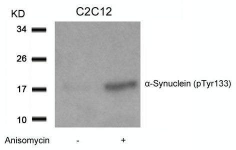 Western blot analysis of extracts from C2C12 cells untreated or treated with Anisomycin using a-Synuclein(Phospho-Tyr133) Antibody.