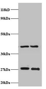 Western blot All lanes: NDUFV2 antibody at 2µg/ml Lane 1: EC109 whole cell lysate Lane 2: 293T whole cell lysate Secondary Goat polyclonal to rabbit IgG at 1/15000 dilution Predicted band size: 28 kDa Observed band size: 28 kDa