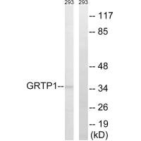 Western blot analysis of extracts from 293 cells, using GRTP1 antibody.