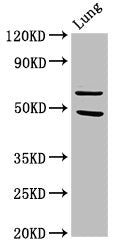 Western Blot Positive WB detected in: Rat lung tissue All lanes: PAK4 antibody at 3.2µg/ml Secondary Goat polyclonal to rabbit IgG at 1/50000 dilution Predicted band size: 65, 48, 49, 55 kDa Observed band size: 65 kDa