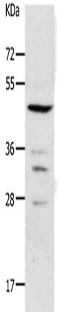 Gel: 10%SDS-PAGE, Lysate: 30 ug, Lane: 231 cells, Primary antibody: CSB-PA054388(PAX2 Antibody) at dilution 1/950, Secondary antibody: Goat anti rabbit IgG at 1/8000 dilution, Exposure time: 10 seconds