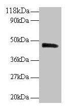 Western blot All lanes: PICK1 antibody at 2µg/ml + Mouse brain tissue Secondary Goat polyclonal to rabbit IgG at 1/10000 dilution Predicted band size: 47, 40 kDa Observed band size: 47 kDa