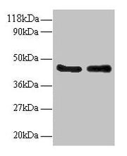 Western blot All lanes: AHSA1 antibody at 2µg/ml Lane 1: EC109 whole cell lysate Lane 2: 293T whole cell lysate Secondary Goat polyclonal to rabbit IgG at 1/15000 dilution Predicted band size: 39, 33 kDa Observed band size: 45 kDa