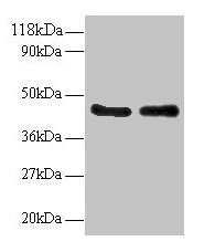 Western blot All lanes: AHSA1 antibody at 2µg/ml Lane 1: EC109 whole cell lysate Lane 2: 293T whole cell lysate Secondary Goat polyclonal to rabbit IgG at 1/15000 dilution Predicted band size: 39, 33 kDa Observed band size: 45 kDa
