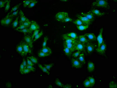 Immunofluorescence staining of HepG2 cells with CSB-PA05484A0Rb at 1:93, counter-stained with DAPI. The cells were fixed in 4% formaldehyde, permeabilized using 0.2% Triton X-100 and blocked in 10% normal Goat Serum. The cells were then incubated...