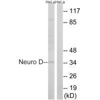 Western blot analysis of extracts from HeLa cells, using Neuro D (Ab-274) antibody.