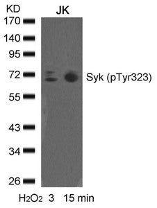 Western blot analysis of extracts from JK cells untreated or treated with H2O2 for the indicated times, using syk(phospho-Tyr323) Antibody.