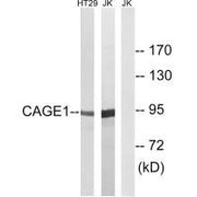 Western blot analysis of extracts from HT-29 cells and Jurkat cells, using CAGE1 antibody.