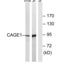Western blot analysis of extracts from HT-29 cells and Jurkat cells, using CAGE1 antibody.
