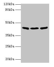 Western blot All lanes: IDH3B antibody at 2µg/ml Lane 1: Hela whole cell lysate Lane 2: Mouse kidney tissue Lane 3: Mouse gonadal tissue Secondary Goat polyclonal to rabbit IgG at 1/10000 dilution Predicted band size: 43, 42, 26 kDa Observed band...