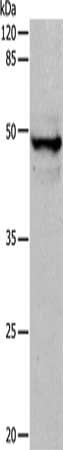 Gel: 10%SDS-PAGE, Lysate: 30 ug, Lane: Mouse thymus tissue, Primary antibody: CSB-PA055420(KRT15 Antibody) at dilution 1/400, Secondary antibody: Goat anti rabbit IgG at 1/8000 dilution, Exposure time: 1.5 minutes