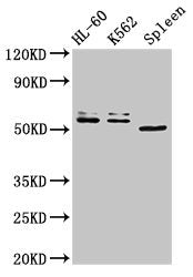 Western Blot Positive WB detected in: HL60 whole cell lysate, K562 whole cell lysate, Mouse spleen tissue All lanes: API5 antibody at 3ug/ml Secondary Goat polyclonal to rabbit IgG at 1/50000 dilution Predicted band size: 60, 50, 57, 51, 58 kDa Ob...