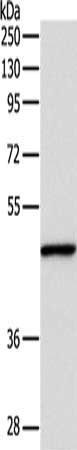 Gel: 8+10%SDS-PAGE, Lysate: 30 ug, Lane: Mouse fat tissue, Primary antibody: CSB-PA055706(INHBA Antibody) at dilution 1/1000, Secondary antibody: Goat anti rabbit IgG at 1/8000 dilution, Exposure time: 10 seconds
