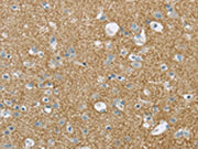 The image on the left is immunohistochemistry of paraffin-embedded Human brain tissue using CSB-PA055935(VAMP2 Antibody) at dilution 1/20, on the right is treated with synthetic peptide. (Original magnification: ×200)