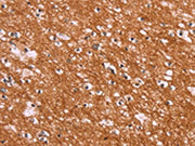 The image on the left is immunohistochemistry of paraffin-embedded Human brain tissue using CSB-PA055939(ENDOG Antibody) at dilution 1/15, on the right is treated with synthetic peptide. (Original magnification: ×200)