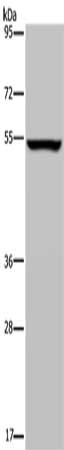 Gel: 8%SDS-PAGE, Lysate: 40 ug, Lane: 293T cells, Primary antibody: CSB-PA056095(PHGDH Antibody) at dilution 1/200, Secondary antibody: Goat anti rabbit IgG at 1/8000 dilution, Exposure time: 1 minute