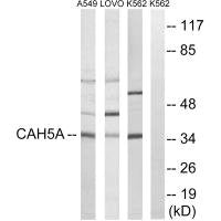 Western blot analysis of extracts from A549 cells, LOVO cells and K562 cells, using CA5A antibody.