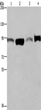 Gel: 6%SDS-PAGE, Lysate: 40 ug, Lane 1-4: A375 cells, LoVo cells, human testis tissue, Hela cells, Primary antibody: CSB-PA056223(ELAC2 Antibody) at dilution 1/250, Secondary antibody: Goat anti rabbit IgG at 1/8000 dilution, Exposure time: 30 sec...
