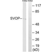 Western blot analysis of extracts from K562 cells, using SVOP antibody.