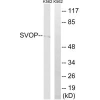 Western blot analysis of extracts from K562 cells, using SVOP antibody.