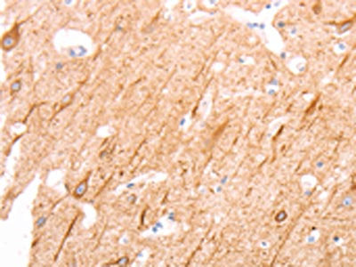 The image on the left is immunohistochemistry of paraffin-embedded Human brain tissue using CSB-PA056378(INA Antibody) at dilution 1/25, on the right is treated with synthetic peptide. (Original magnification: ×200)