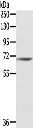 Gel: 8%SDS-PAGE,Lysate: 40 ug,,Primary antibody: CSB-PA056452(IL18R1 Antibody) at dilution 1/200 dilution,Secondary antibody: Goat anti rabbit IgG at 1/8000 dilution,Exposure time: 1 minute
