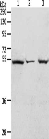 Gel: 10%SDS-PAGE, Lysate: 40 ug, Lane 1-3: Hela cells, mouse heart tissue, Jurkat cells, Primary antibody: CSB-PA056862(TCF7 Antibody) at dilution 1/300, Secondary antibody: Goat anti rabbit IgG at 1/8000 dilution, Exposure time: 1 minute