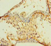 Immunohistochemistry of paraffin-embedded human testis tissue using CSB-PA05699A0Rb at dilution of 1:100