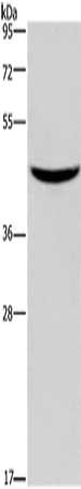 Gel: 10%SDS-PAGE, Lysate: 40 ug, Lane: Mouse pancreas tissue, Primary antibody: CSB-PA057280(GIPR Antibody) at dilution 1/150, Secondary antibody: Goat anti rabbit IgG at 1/8000 dilution, Exposure time: 10 seconds