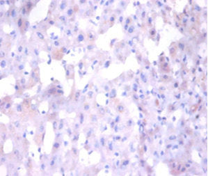 Immunohistochemistry of paraffin-embedded human liver tissue using CSB-PA05729A0Rb at dilution of 1:100