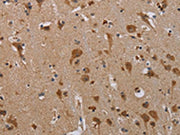 The image on the left is immunohistochemistry of paraffin-embedded Human brain tissue using CSB-PA057327(PARP3 Antibody) at dilution 1/20, on the right is treated with synthetic peptide. (Original magnification: ×200)