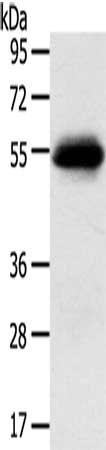 Gel: 8%SDS-PAGE, Lysate: 40 ug, Lane: 823 cells, Primary antibody: CSB-PA057466(SLC7A5 Antibody) at dilution 1/250, Secondary antibody: Goat anti rabbit IgG at 1/8000 dilution, Exposure time: 2 minutes