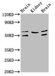 Western Blot Positive WB detected in: Rat brain tissue, Rat kidney tissue, Mouse brain tissue All lanes: ANGPT2 antibody at 3.2µg/ml Secondary Goat polyclonal to rabbit IgG at 1/50000 dilution Predicted band size: 57, 51 kDa Observed band size: 57...
