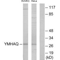 Western blot analysis of extracts from HUVEC cells and HeLa cells, using 14-3-3 θ antibody.