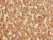 Immunohistochemistry of paraffin-embedded human liver tissue using CSB-PA05759A0Rb at dilution of 1:100