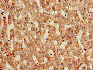 Immunohistochemistry of paraffin-embedded human liver tissue using CSB-PA05759A0Rb at dilution of 1:100