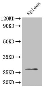 Western Blot Positive WB detected in: Mouse spleen tissue All lanes: BDNF antibody at 4µg/ml Secondary Goat polyclonal to rabbit IgG at 1/50000 dilution Predicted band size: 28, 29, 30, 38, 32 kDa Observed band size: 28 kDa