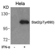 Western blot analysis of extracts from Hela cells untreated or treated with IFN-a using Stat2(phospho-Tyr690) Antibody.