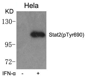 Western blot analysis of extracts from Hela cells untreated or treated with IFN-a using Stat2(phospho-Tyr690) Antibody.