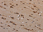 The image on the left is immunohistochemistry of paraffin-embedded Human brain tissue using CSB-PA058322(PLXNB1 Antibody) at dilution 1/40, on the right is treated with synthetic peptide. (Original magnification: ×200)