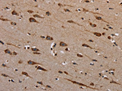 The image on the left is immunohistochemistry of paraffin-embedded Human brain tissue using CSB-PA058322(PLXNB1 Antibody) at dilution 1/40, on the right is treated with synthetic peptide. (Original magnification: ×200)