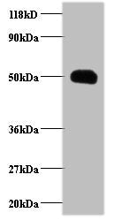 Western blot All lanes: CCL2 antibody at 2µg/ml + EC109 whole cell lysate Secondary Goat polyclonal to rabbit IgG at 1/15000 dilution Predicted band size: 12 kDa Observed band size: 50 kDa