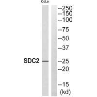 Western blot analysis of extracts from COLO cells, using SDC2 antibody.