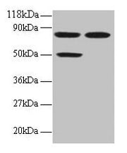 Western blot All lanes: CCL22 antibody at 2µg/ml Lane 1: 293T whole cell lysate Lane 2: EC109 whole cell lysate Secondary Goat polyclonal to rabbit IgG at 1/15000 dilution Predicted band size: 11 kDa Observed band size: 50, 80 kDa