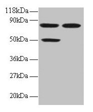 Western blot All lanes: CCL22 antibody at 2µg/ml Lane 1: 293T whole cell lysate Lane 2: EC109 whole cell lysate Secondary Goat polyclonal to rabbit IgG at 1/15000 dilution Predicted band size: 11 kDa Observed band size: 50, 80 kDa