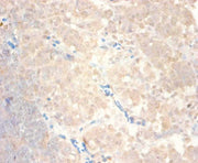 Immunohistochemistry of paraffin-embedded human lymph node tissue using CSB-PA05909A0Rb at dilution of 1:100